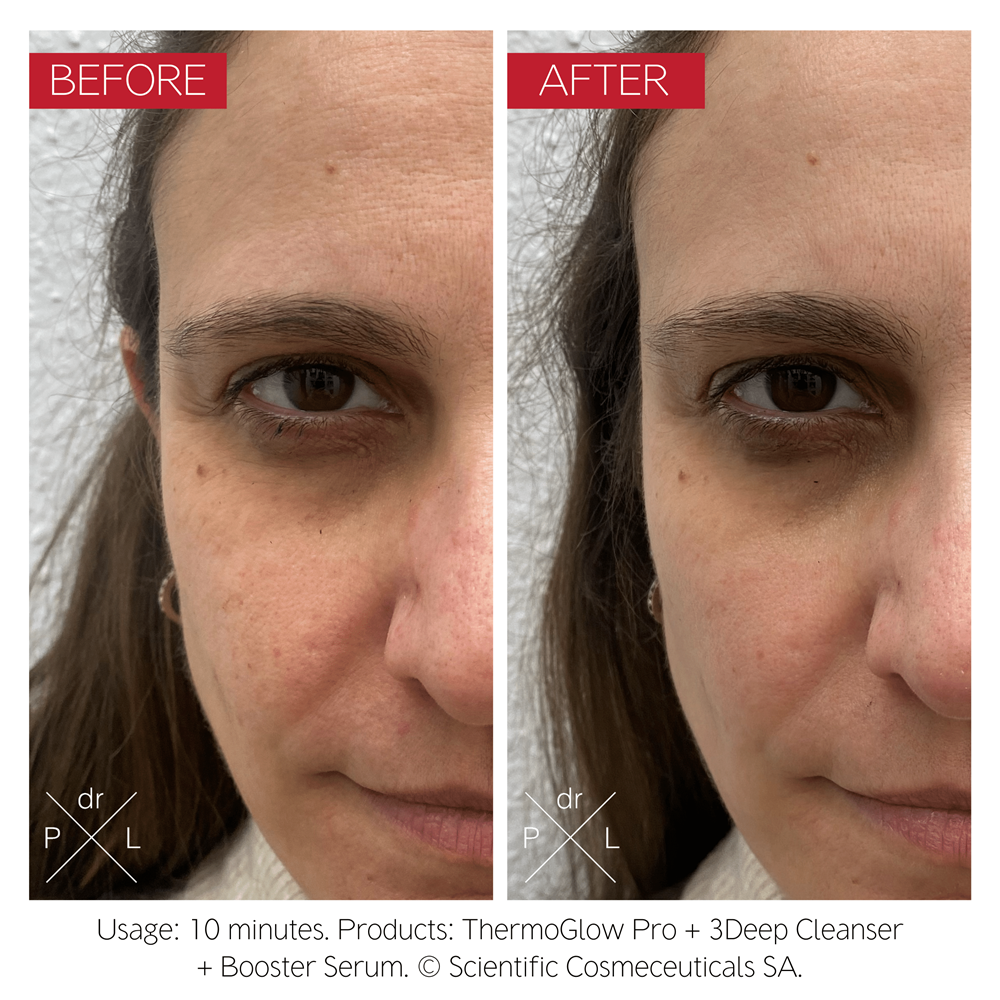 Dr Levy ThermoGlow Pro - Image 3